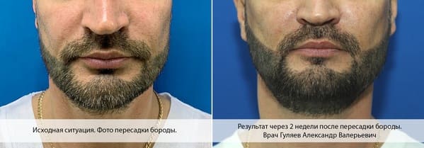 Пример 21