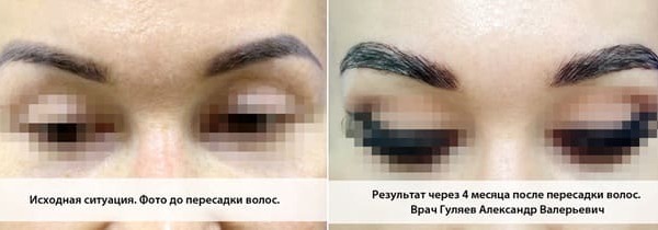 Пример 22